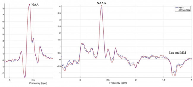 Концентрации N-ацетиласпартилглутамата и N-ацетиласпартата в мозге человека при постоянной зрительной активации по данным функциональной магнитно-резонансной спектроскопии
